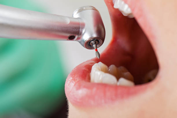 Best Urgent Dental Care for Toothache in Belville, NC